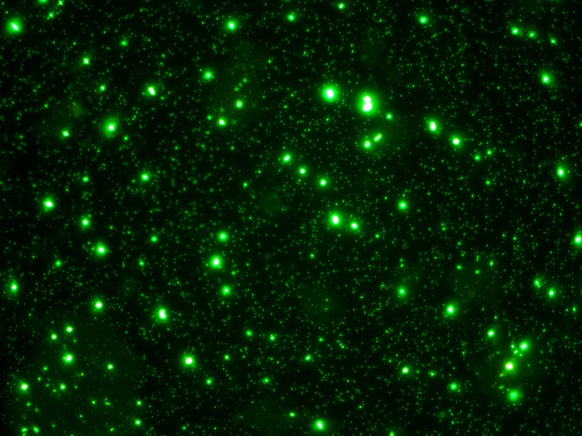 Gröna fläckar på svart bakgrund. Bild från mikroskop på bakterier och viruslika partiklar. 